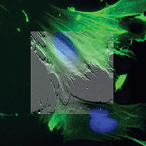原子力显微镜下细胞的图像叠加在荧光显微镜下相同细胞的图像上