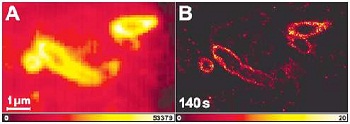 图2:大肠杆菌常规成像(A)和PALMIRA成像(B)， 200 nm厚的标记大肠杆菌的细胞质膜冷冻切片(来自:A. Egner等人，生物物理学杂志，2007)