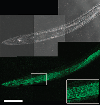 活蠕虫dCALM共聚焦成像激活cd4分裂GFP在体壁肌肉表面