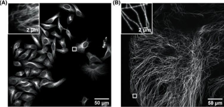 HeLa细胞未扩张微管共聚焦图像